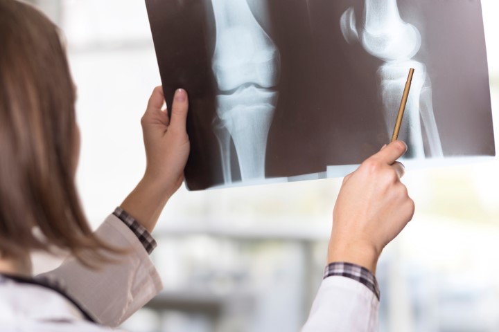How-you-Can-Fight-Osteoporosis