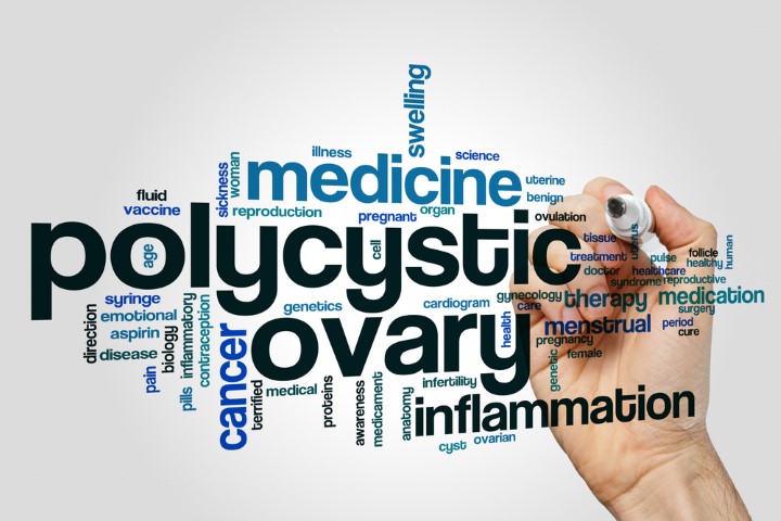 What_are_the_Common_Symptoms_of_Polycystic_Ovary_Syndrome_PCOS