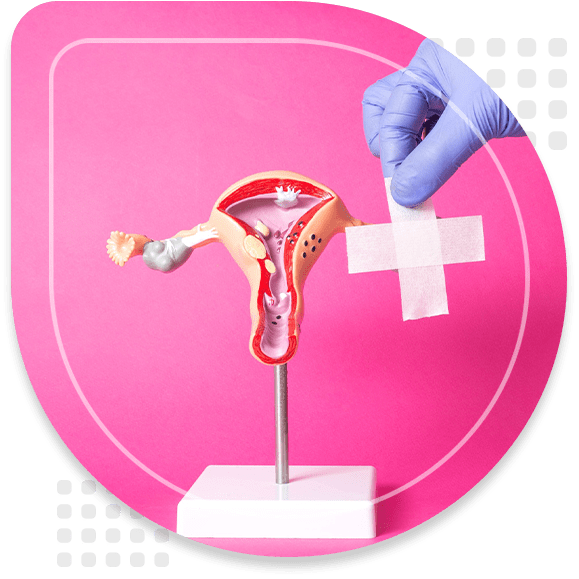 Doctor holding a medical plaster near the layout of the female reproductive system on a pink background. Concept of surgical operations for women, intimate plastics, correction of the labia.