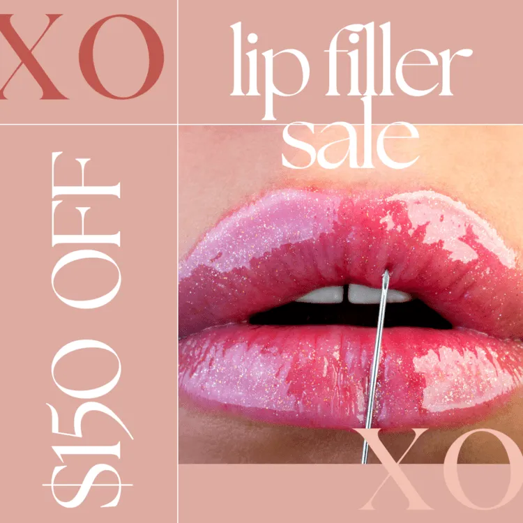 Lip Filler Sale -$150 Off