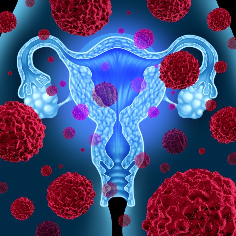 Warning-Signs-of-Common-Gynecological-Cancers