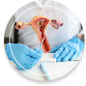 Gynecologist holds model of female reproductive system and cytological brush